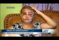 Conciencia sobre la violencia doméstica: Imágenes impactantes de mujer golpeada por su esposo